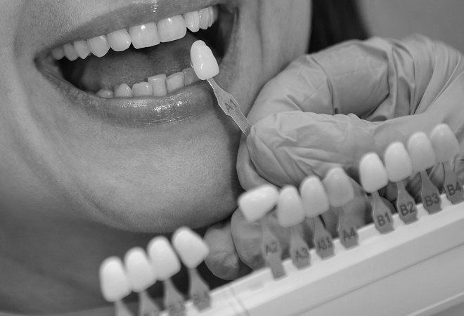 Cosmetic dental care at Westlake Smile Design for Calabasas patients