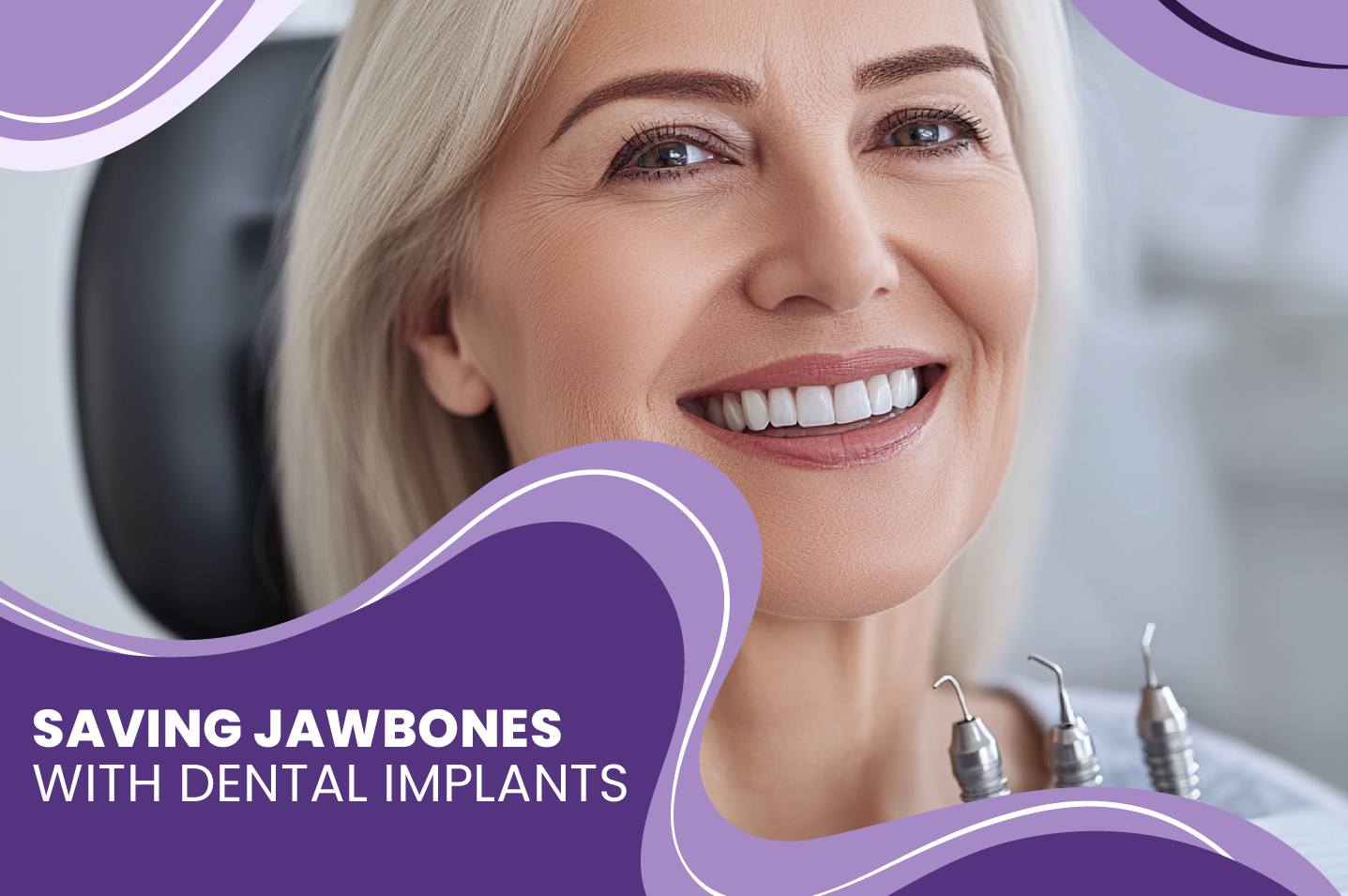 Saving Jawbones with Dental Implants